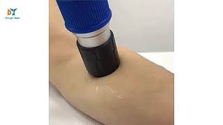 shovewave pain therapy Radial Focused Shockwave Therapy Machine #danyelaser #healthylifestyle