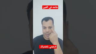 ماذا تدل الشامه في العين - اسمعها