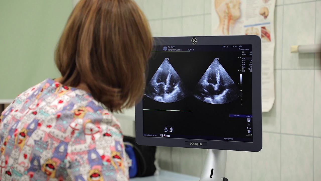 4  Апикальная четырехкамерная позиция