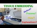 Tissue embedding histopathologyautomated tissue embedderhistopathologyautomationstar laboratory