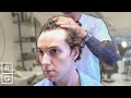 &quot;The Hairline&#39;s Going BACK... I&#39;ve Noticed HAIR LOSS on the Sides&quot; | Talking Hair Loss EP 2