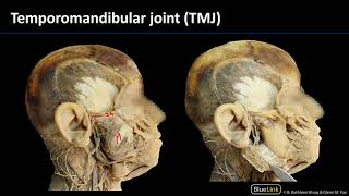 Msk Lab 1 Station 9 - Temporomandibular Joint (Tmj)