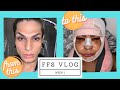 Facial Feminization Surgery| Vlog Week 1