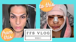 Facial Feminization Surgery| Vlog Week 1 Wealth