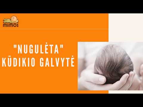 Video: Kaip Apsaugoti Savo Kūdikį Nuo Uodų