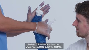 Boxer Functional Cast by Delta-Cast®