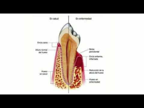 Vídeo: Caracterización Comparativa Del Genoma Del Patógeno Periodontal Tannerella Forsythia