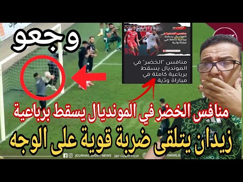 😱لوكا زيدان يتلقى ضربة على الوجه من زميله ويؤكد عدم جاهزيته/منافس الخضر في المونديال يتلقى 4اهداف
