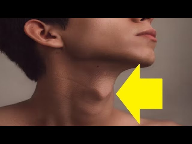 GET A BIG ADAM'S APPLE BY DOING THIS 1 EXERCISE - YouTube GET A BIG ADAM'S APPLE BY DOING THIS 1 EXERCISE - YouTube