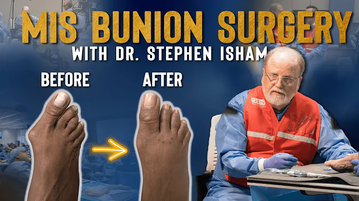 Minimally Invasive Bunion Surgery | Dr. TJ Ahn