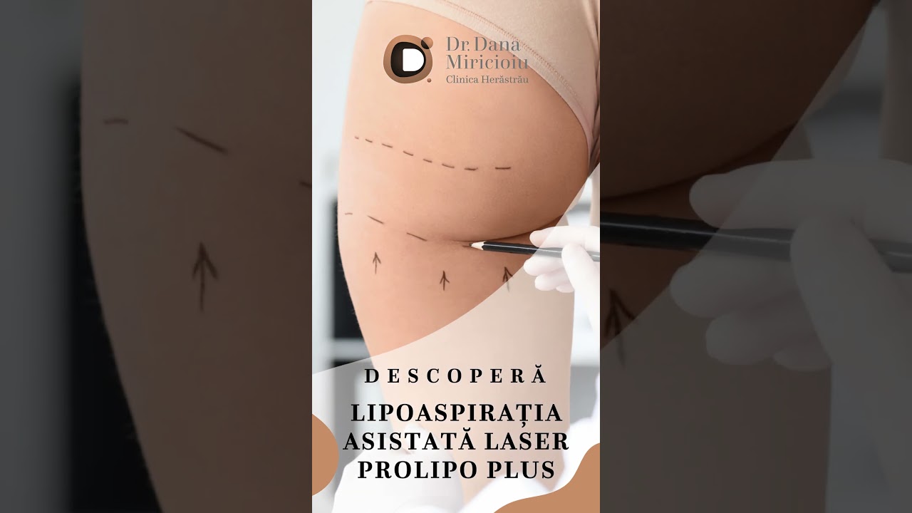 Lipoaspirația asistată laser 4D ProLipo Plus - recontureaza corpul si creștere fermitatea pielii.