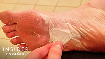 ¿Cómo mejorar la piel de los pies?