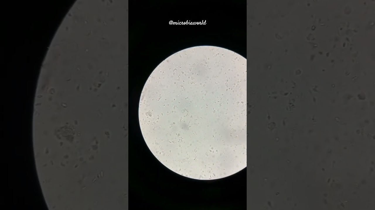 sperm microscopy🔬 