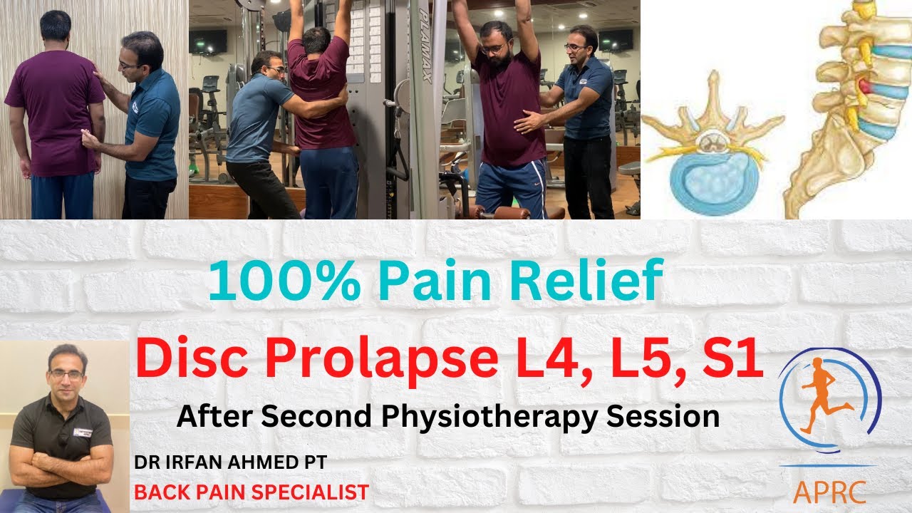 Patient with Disc Prolapse L5&S1 Got 100 Pain Relief after 2nd