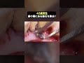 20年以上溜まった大量の歯石をスッキリ除去✨