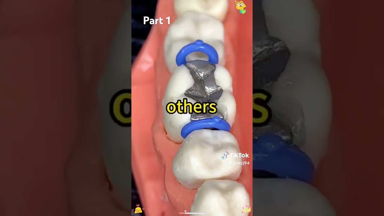 Part 1. Part 2 posted 