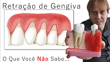 Tem como recuperar a gengiva?