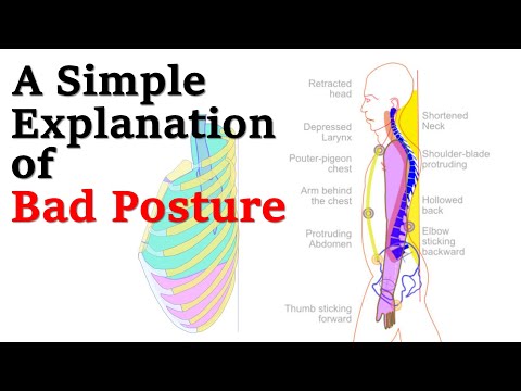 A Simple Explanation Of Bad Posture 