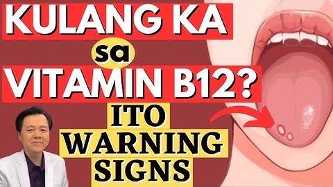 Kulang Ka sa Vitamin B12? Ito Warning Signs. - By Doc Willie Ong (Internist and Cardiologist)