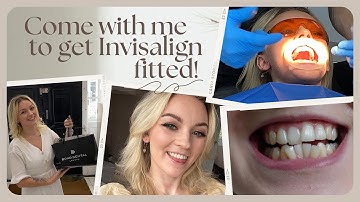Getting Invisalign Fitted and my First Week Review! | Bond Dental, AD PR 🦷