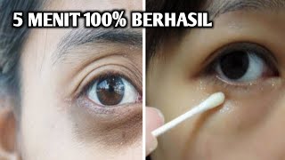 5 Minutes To Get Away From Panda Eyes And Eye Bags