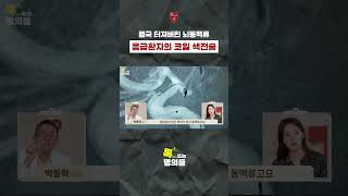 지주막하출혈이 발생한 응급환자, 개두술이 아닌 시술로?