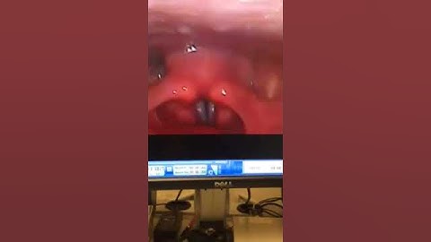 Larynx figure then add AES