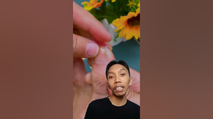 Gunting Kuku Jempol Kaki Anti Cantengan | Home Gadgets #shorts