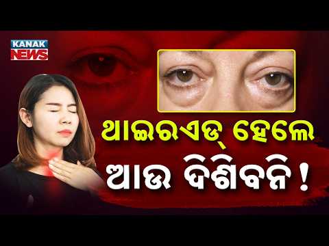 ଥାଇରଏଡ୍ ହେଲେ ଆଉ ଦିଶିବନି ! Special Report On Thyroid Impact On Eye | Warning About Vision Loss Risk