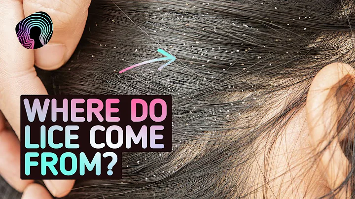 Your Body On Lice (Warning: Distressing Footage) - DayDayNews