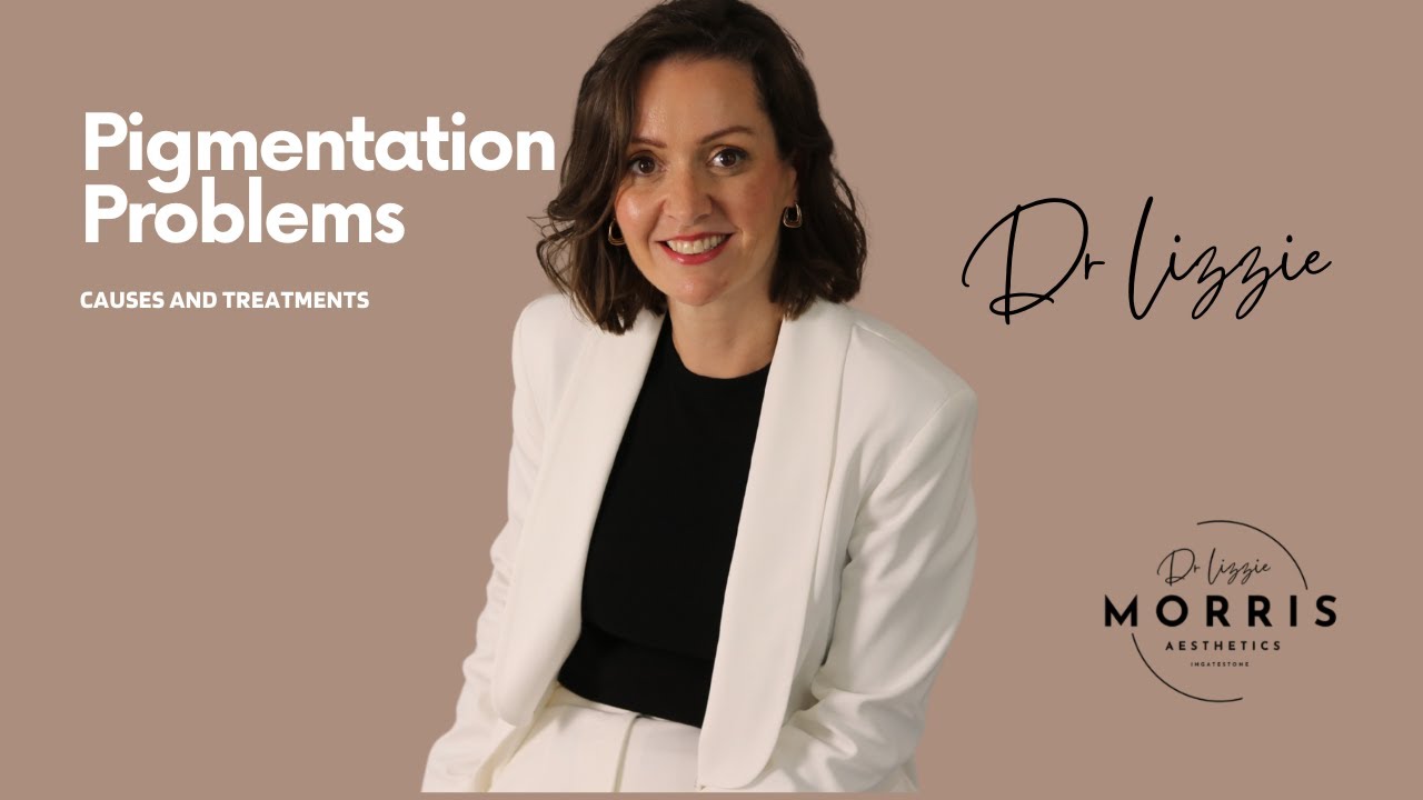 Dr Lizzie recommends treatments for pigmentation problems