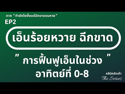 เอ็นร้อยหวายฉีกขาด ในสัปดาห์ที่ 0 ถึง 8 ควรปฎิบัติตัวอย่างไร (ซีรีย์เอ็นร้อยหวายฉีกขาด ตอนที่ 2 )