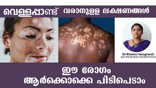 വെള്ളപ്പാണ്ട്  വരാനുള്ള ലക്ഷണങ്ങൾ  I Vitiligo I Dr Roshni I Ayurveda I Malayalam