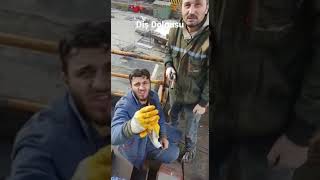 Diş Dolgusu Böyle Yapılır