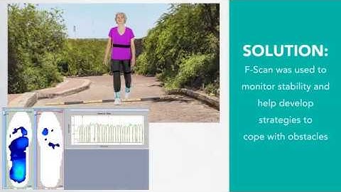 F Scan: In-Shoe Technology for Fall-Risk Assessment