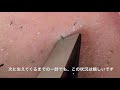 【pull out the beard】ずっと見てられる平凡なヒゲ抜き 2018.4.25
