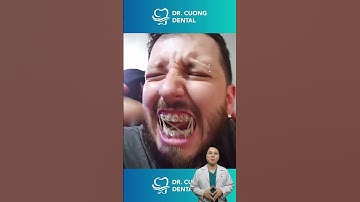 Chun niềng răng sẽ như thế nào? | Bác sĩ Cường