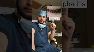 Common Eye Problems And Solutions