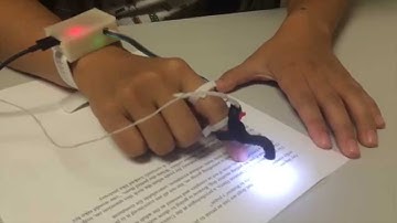 HandSight: A Finger-Mounted Camera & Feedback System to Enable Reading of Printed Text for the Blind
