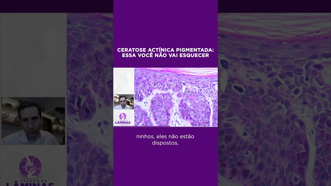 Não conhecer esse fenômeno pode tirar o sono de patologistas e dermatologistas