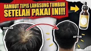 BERHASIL.! Cara Mengatasi Kerontokan Dan Menumbuhkan Rambut Yang Tipis