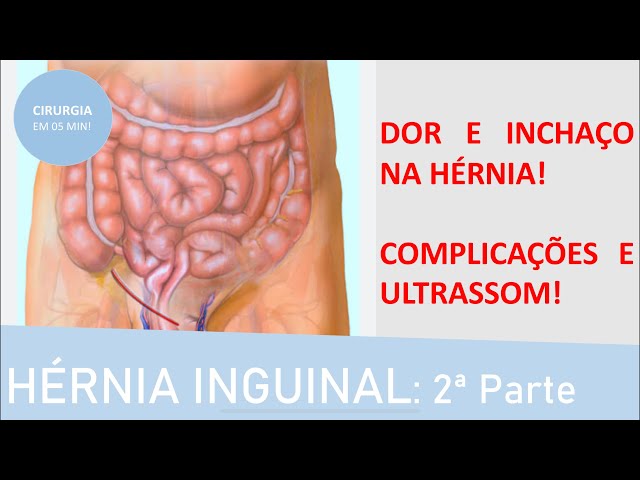 Hérnias inguinais ligadas a problemas do quadril — Dr. David