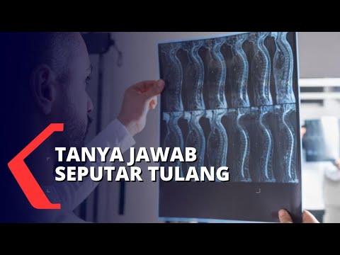 Apa Dampaknya Jika Patah Tulang Klavikula Dibiarkan Begitu Saja?