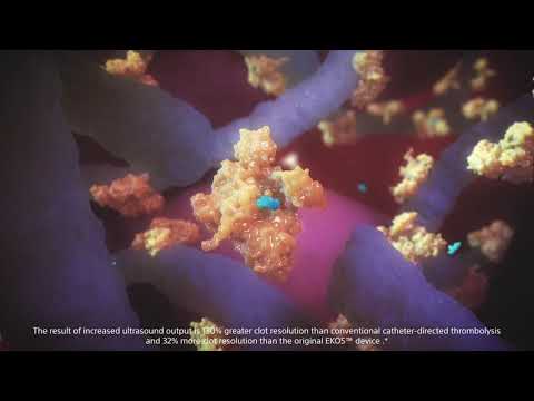 EKOS+ Endovascular System: How it Works