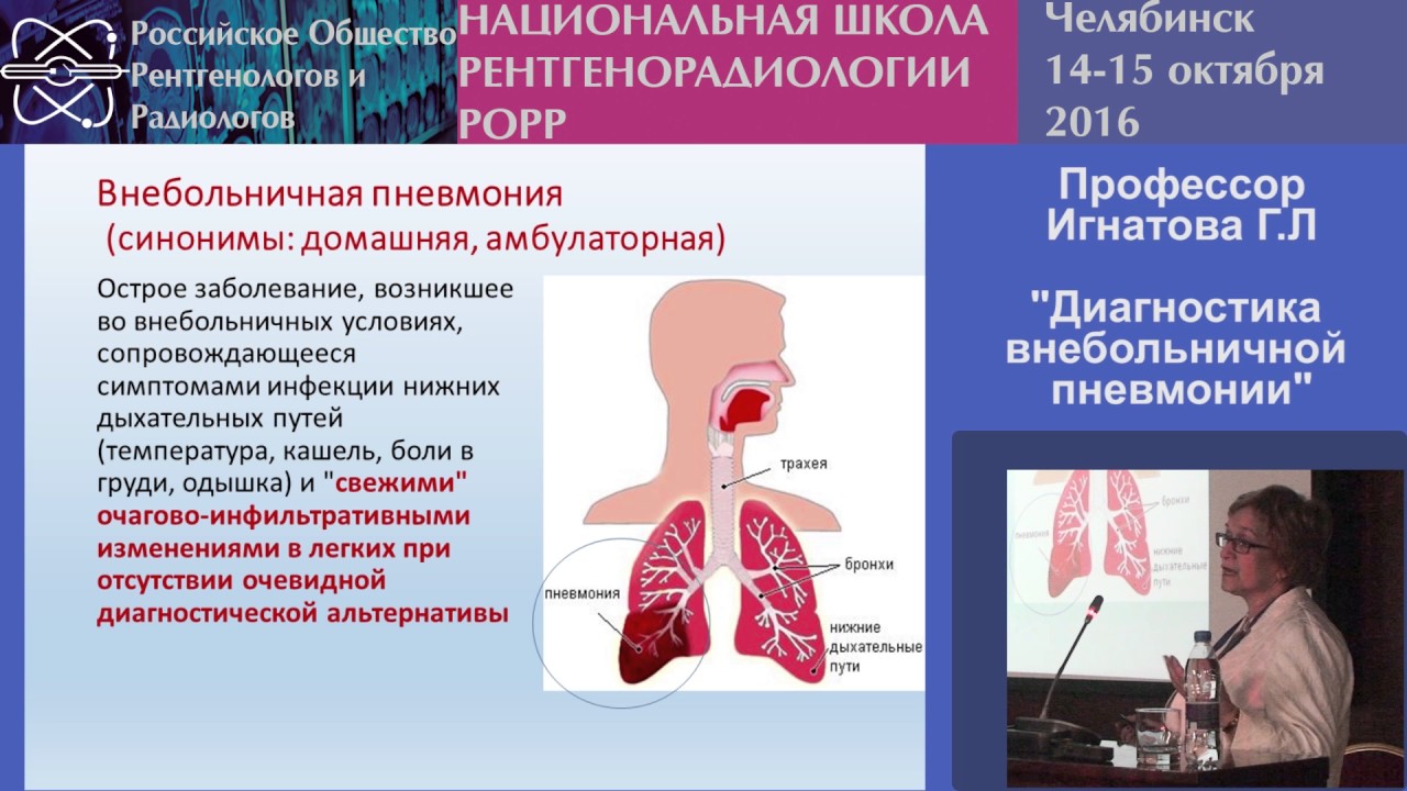 Г.Л. Игнатова - Диагностика внебольничной пневмонии