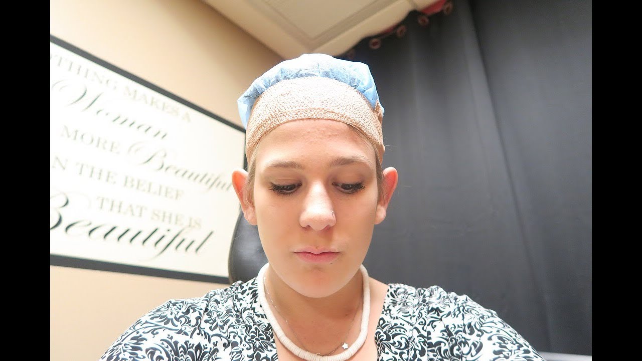 my otoplasty surgery experience/vlog