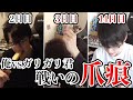 ガリガリ君5BOXバカ食いした結果www