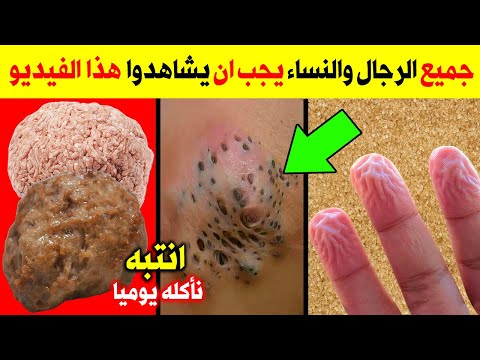 انتبه نأكله يوميا وهو سم قاتل🥫 يدمر الكبد يعطل البنكرياس يسبب الضعف وسرطان البروستاتا ومرض السكري