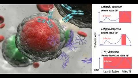 Learning Zone Movie 3 - IGRAs (Interferon Gamma Release Assay)
