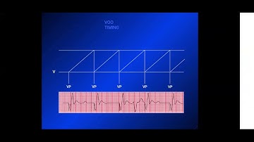 Lecture 4 : Understanding the pacemaker  (Pacemaker timing cycles) - Dr.  Emmanual Fares